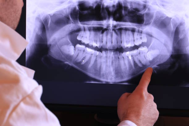 Best Emergency Broken Tooth Repair in Kentland, IN