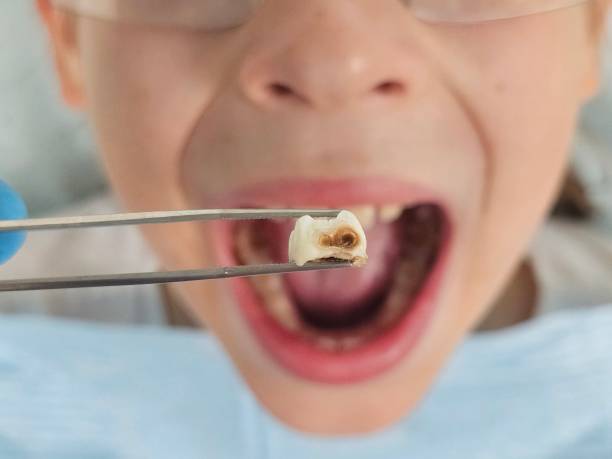 Best Pediatric Emergency Dentist in Kentland, IN